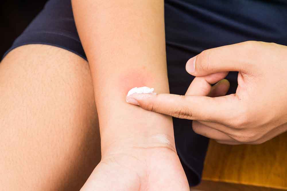 OLT及(ji)其軟膏